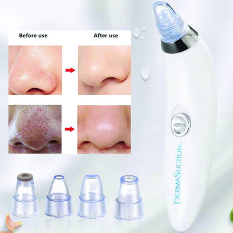 Derma Suction Blackhead Acne Oil Remover